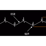 干貨分享 | 電源的紋波和噪聲是什么？怎么測？